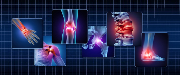 fibromialgia-sintomas-inflamatorios